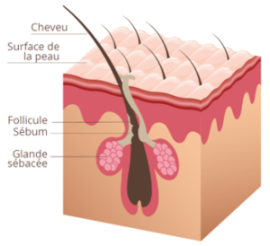 Schema cheveux gras